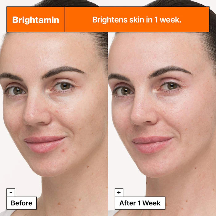 Brightamin Brightening Serum with Niacinamide and Vitamin C