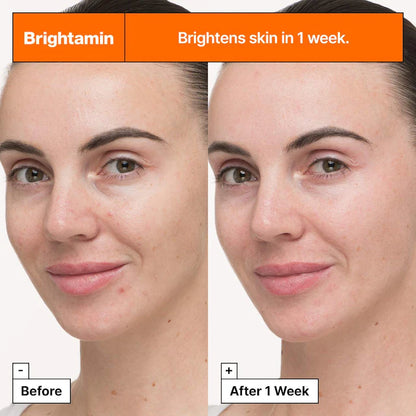 Brightamin Brightening Serum with Niacinamide and Vitamin C